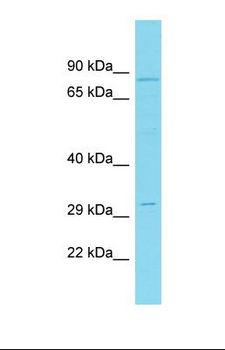CNOT10 Antibody - Western blot of Human PANC1. CNOT10 antibody dilution 1.0 ug/ml.  This image was taken for the unconjugated form of this product. Other forms have not been tested.
