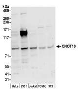 CNOT10 Antibody - Detection of human and mouse CNOT10 by western blot. Samples: Whole cell lysate (50 µg) from HeLa, HEK293T, Jurkat, mouse TCMK-1, and mouse NIH 3T3 cells prepared using NETN lysis buffer. Antibody: Affinity purified rabbit anti-CNOT10 antibody used for WB at 0.04 µg/ml. Detection: Chemiluminescence with an exposure time of 30 seconds.