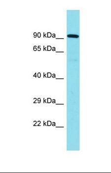 CNOT10 Antibody - Western blot of Human Placenta. CNOT10 antibody dilution 1.0 ug/ml.  This image was taken for the unconjugated form of this product. Other forms have not been tested.