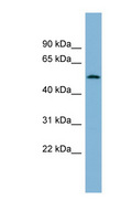 CNOT11 / C2orf29 Antibody - C2orf29 antibody Western blot of Fetal Thymus lysate. This image was taken for the unconjugated form of this product. Other forms have not been tested.