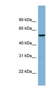 CNOT11 / C2orf29 Antibody - C2orf29 antibody Western blot of MCF7 cell lysate. This image was taken for the unconjugated form of this product. Other forms have not been tested.