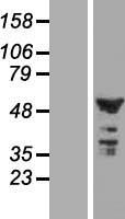 CNOT11 / C2orf29 Protein - Western validation with an anti-DDK antibody * L: Control HEK293 lysate R: Over-expression lysate