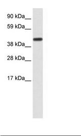 CNOT2 Antibody - Fetal Liver Lysate.  This image was taken for the unconjugated form of this product. Other forms have not been tested.