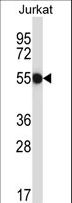 CNOT2 Antibody - CNOT2 Antibody western blot of Jurkat cell line lysates (35 ug/lane). The CNOT2 antibody detected the CNOT2 protein (arrow).