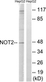 CNOT2 Antibody - Western blot analysis of lysates from HepG2 cells, treated with starved 24h, using CNOT2 Antibody. The lane on the right is blocked with the synthesized peptide.