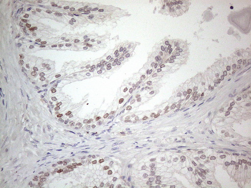 CNOT2 Antibody - Immunohistochemical staining of paraffin-embedded Human prostate tissue within the normal limits using anti-CNOT2 mouse monoclonal antibody. (Heat-induced epitope retrieval by 1mM EDTA in 10mM Tris buffer. (pH8.5) at 120°C for 3 min. (1:150)