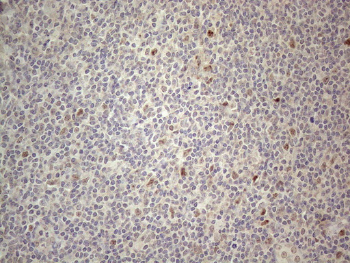 CNOT2 Antibody - Immunohistochemical staining of paraffin-embedded Human tonsil within the normal limits using anti-CNOT2 mouse monoclonal antibody. (Heat-induced epitope retrieval by 1mM EDTA in 10mM Tris buffer. (pH8.5) at 120°C for 3 min. (1:150)