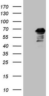 CNOT2 Antibody - HEK293T cells were transfected with the pCMV6-ENTRY control. (Left lane) or pCMV6-ENTRY CNOT2. (Right lane) cDNA for 48 hrs and lysed. Equivalent amounts of cell lysates. (5 ug per lane) were separated by SDS-PAGE and immunoblotted with anti-CNOT2. (1:2000)