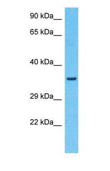CNOT2 Antibody - Western blot of CNOT2 Antibody with human HeLa Whole Cell lysate.  This image was taken for the unconjugated form of this product. Other forms have not been tested.