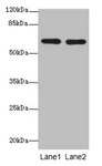CNOT2 Antibody - Western blot All lanes: CNOT2 antibody at 2µg/ml Lane 1: 293T whole cell lysate Lane 2: Jurkat whole cell lysate Secondary Goat polyclonal to rabbit IgG at 1/10000 dilution Predicted band size: 60, 41, 23, 52, 55 kDa Observed band size: 60 kDa
