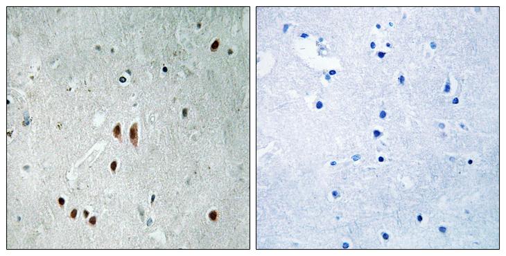 CNOT2 Antibody - P-peptide - + Immunohistochemistry analysis of paraffin-embedded human brain tissue using CNOT2 (Phospho-Ser101) antibody. CNOT2 (Phospho-Ser101) antibody reacts with epitope-specific phosphopeptide and corresponding non-phosphopeptide.