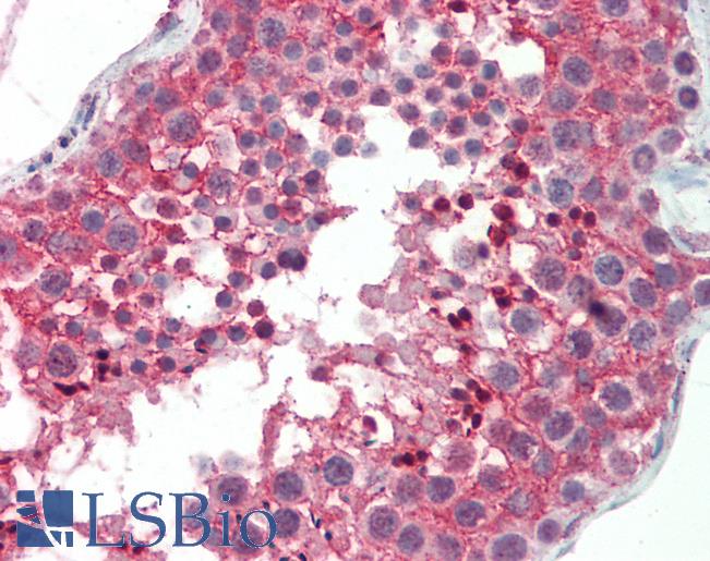 CNOT3 Antibody - Anti-CNOT3 antibody IHC staining of human testis. Immunohistochemistry of formalin-fixed, paraffin-embedded tissue after heat-induced antigen retrieval. Antibody concentration 5 ug/ml.  This image was taken for the unconjugated form of this product. Other forms have not been tested.