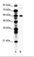CNOT3 Antibody - A: Marker, B: Jurkat Cell Lysate.  This image was taken for the unconjugated form of this product. Other forms have not been tested.