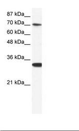 CNOT3 Antibody - HepG2 Cell Lysate.  This image was taken for the unconjugated form of this product. Other forms have not been tested.