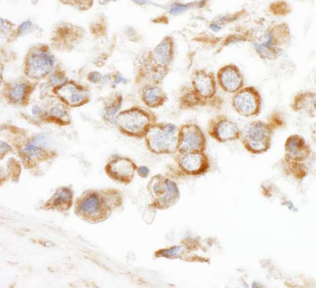 CNOT3 Antibody - Detection of Human CNOT3 by Immunohistochemistry. Sample: FFPE section of human testicular seminoma. Antibody: Affinity purified rabbit anti-CNOT3 used at a dilution of 1:200 (1 ug/ml).