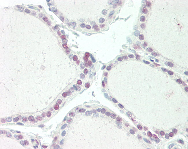 CNOT3 Antibody - Human Thyroid: Formalin-Fixed, Paraffin-Embedded (FFPE).  This image was taken for the unconjugated form of this product. Other forms have not been tested.