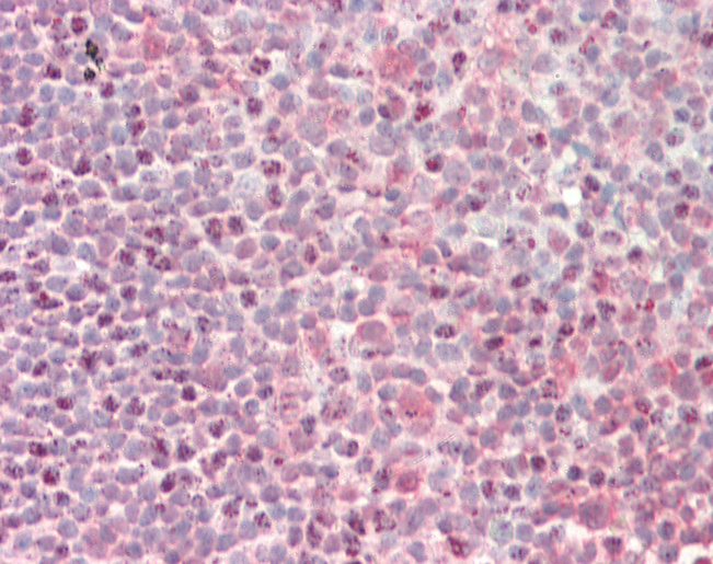 CNOT3 Antibody - Human Tonsil: Formalin-Fixed, Paraffin-Embedded (FFPE).  This image was taken for the unconjugated form of this product. Other forms have not been tested.