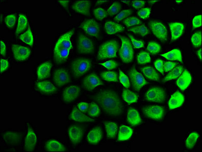 CNOT3 Antibody - Immunofluorescence staining of Hela cells with CNOT3 Antibody at 1:33, counter-stained with DAPI. The cells were fixed in 4% formaldehyde, permeabilized using 0.2% Triton X-100 and blocked in 10% normal Goat Serum. The cells were then incubated with the antibody overnight at 4°C. The secondary antibody was Alexa Fluor 488-congugated AffiniPure Goat Anti-Rabbit IgG(H+L).