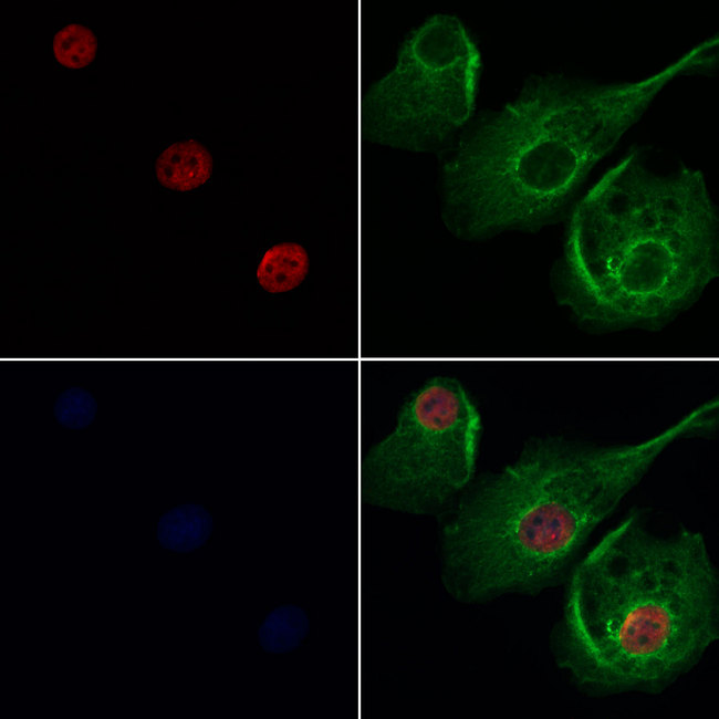 CNOT3 Antibody - Staining HeLa cells by IF/ICC. The samples were fixed with PFA and permeabilized in 0.1% Triton X-100, then blocked in 10% serum for 45 min at 25°C. Samples were then incubated with primary Ab(1:200) and mouse anti-beta tubulin Ab(1:200) for 1 hour at 37°C. An AlexaFluor594 conjugated goat anti-rabbit IgG(H+L) Ab(1:200 Red) and an AlexaFluor488 conjugated goat anti-mouse IgG(H+L) Ab(1:600 Green) were used as the secondary antibod