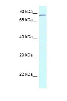 CNOT3 Antibody - CNOT3 antibody Western blot of Rat Liver lysate. Antibody concentration 1 ug/ml.  This image was taken for the unconjugated form of this product. Other forms have not been tested.