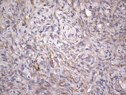 CNOT4 / CLONE243 Antibody - IHC of paraffin-embedded Human Ovary tissue using anti-CNOT4 Mouse monoclonal antibody. (heat-induced epitope retrieval by 1 mM EDTA in 10mM Tris, pH8.5, 120°C for 3min).