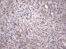 CNOT4 / CLONE243 Antibody - IHC of paraffin-embedded Human Ovary tissue using anti-CNOT4 Mouse monoclonal antibody. (heat-induced epitope retrieval by 1 mM EDTA in 10mM Tris, pH8.5, 120°C for 3min).