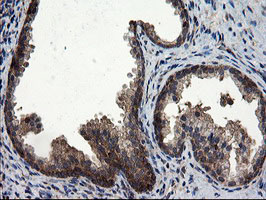 CNOT4 / CLONE243 Antibody - IHC of paraffin-embedded Human prostate tissue using anti-CNOT4 mouse monoclonal antibody.