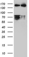 CNOT4 / CLONE243 Antibody - HEK293T cells were transfected with the pCMV6-ENTRY control (Left lane) or pCMV6-ENTRY CNOT4 (Right lane) cDNA for 48 hrs and lysed. Equivalent amounts of cell lysates (5 ug per lane) were separated by SDS-PAGE and immunoblotted with anti-CNOT4.