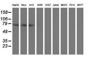 CNOT4 / CLONE243 Antibody - Western blot of extracts (35ug) from 9 different cell lines by using anti-CNOT4 monoclonal antibody (HepG2: human; HeLa: human; SVT2: mouse; A549: human; COS7: monkey; Jurkat: human; MDCK: canine; PC12: rat; MCF7: human).