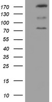 CNOT4 / CLONE243 Antibody - HEK293T cells were transfected with the pCMV6-ENTRY control (Left lane) or pCMV6-ENTRY CNOT4 (Right lane) cDNA for 48 hrs and lysed. Equivalent amounts of cell lysates (5 ug per lane) were separated by SDS-PAGE and immunoblotted with anti-CNOT4.