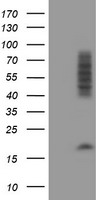 CNOT4 / CLONE243 Antibody - HEK293T cells were transfected with the pCMV6-ENTRY control (Left lane) or pCMV6-ENTRY CNOT4 (Right lane) cDNA for 48 hrs and lysed. Equivalent amounts of cell lysates (5 ug per lane) were separated by SDS-PAGE and immunoblotted with anti-CNOT4.