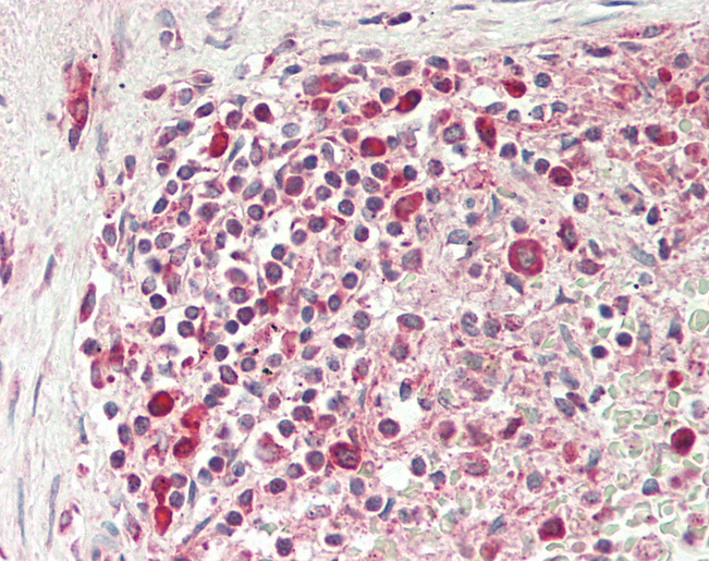 CNOT4 / CLONE243 Antibody - Human Spleen: Formalin-Fixed, Paraffin-Embedded (FFPE).  This image was taken for the unconjugated form of this product. Other forms have not been tested.