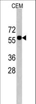 CNOT4 / CLONE243 Antibody - Western blot of CNOT4 Antibody in CEM cell line lysates (35 ug/lane). CNOT4 (arrow) was detected using the purified antibody.