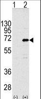 CNOT4 / CLONE243 Antibody - Western blot of CNOT4 (arrow) using rabbit polyclonal CNOT4 Antibody (RB11916). 293 cell lysates (2 ug/lane) either nontransfected (Lane 1) or transiently transfected with the CNOT4 gene (Lane 2) (Origene Technologies).