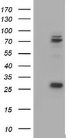 CNOT4 / CLONE243 Antibody - HEK293T cells were transfected with the pCMV6-ENTRY control (Left lane) or pCMV6-ENTRY CNOT4 (Right lane) cDNA for 48 hrs and lysed. Equivalent amounts of cell lysates (5 ug per lane) were separated by SDS-PAGE and immunoblotted with anti-CNOT4.