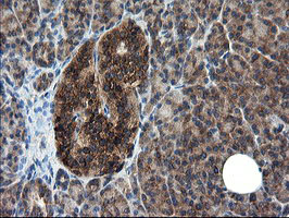 CNOT4 / CLONE243 Antibody - IHC of paraffin-embedded Human pancreas tissue using anti-CNOT4 mouse monoclonal antibody.