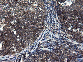 CNOT4 / CLONE243 Antibody - IHC of paraffin-embedded Human tonsil using anti-CNOT4 mouse monoclonal antibody.