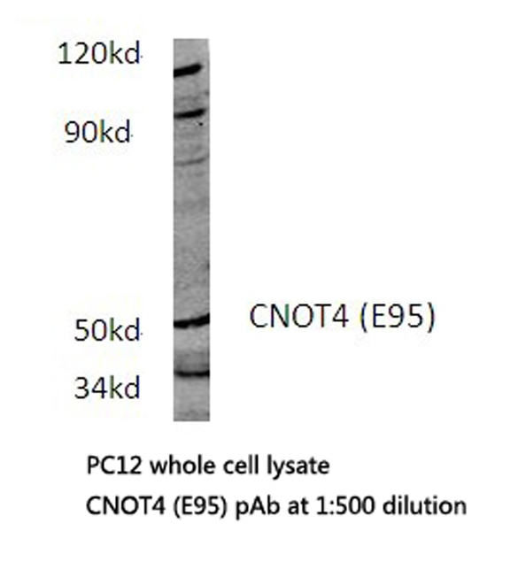 CNOT4 / CLONE243 Antibody - Western blot of CNOT4 (E95) pAb in extracts from PC12 cells.