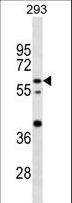 CNOT4 / CLONE243 Antibody - CNOT4 Antibody western blot of 293 cell line lysates (35 ug/lane). The CNOT4 antibody detected the CNOT4 protein (arrow).