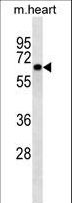 CNOT4 / CLONE243 Antibody - CNOT4 Antibody western blot of mouse heart tissue lysates (35 ug/lane). The CNOT4 antibody detected the CNOT4 protein (arrow).