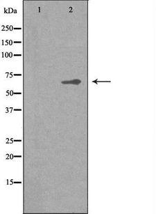 CNOT4 / CLONE243 Antibody - Western blot analysis of extracts of K562 cells using CNOT4 antibody. The lane on the left is treated with the antigen-specific peptide.