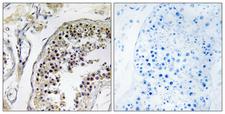 CNOT4 / CLONE243 Antibody - Peptide - + Immunohistochemistry analysis of paraffin-embedded human testis tissue, using CNOT4 antibody.