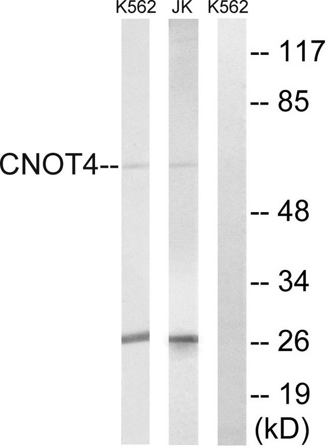 CNOT4 / CLONE243 Antibody - Western blot analysis of extracts from K562 cells and Jurkat cells, using CNOT4 antibody.