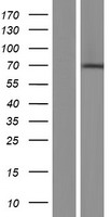 CNOT4 / CLONE243 Protein - Western validation with an anti-DDK antibody * L: Control HEK293 lysate R: Over-expression lysate
