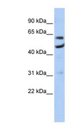 CNOT6 Antibody - CNOT6 antibody Western blot of Jurkat lysate. This image was taken for the unconjugated form of this product. Other forms have not been tested.