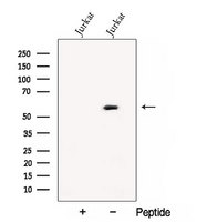 CNOT6 Antibody - Western blot analysis of extracts of Jurkat cells using CNOT6 antibody. The lane on the left was treated with blocking peptide.