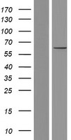 CNOT6 Protein - Western validation with an anti-DDK antibody * L: Control HEK293 lysate R: Over-expression lysate