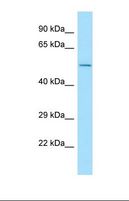 CNOT6L Antibody - Western blot of Human HepG2. CNOT6L antibody dilution 1.0 ug/ml.  This image was taken for the unconjugated form of this product. Other forms have not been tested.