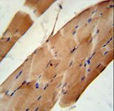 CNOT6L Antibody - CNO6L Antibody immunohistochemistry of formalin-fixed and paraffin-embedded human skeletal muscle followed by peroxidase-conjugated secondary antibody and DAB staining.
