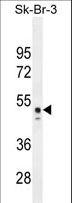 CNOT6L Antibody - CNO6L Antibody western blot of Sk-Br-3 cell line tissue lysates (35 ug/lane). The CNO6L antibody detected the CNO6L protein (arrow).